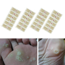 Load image into Gallery viewer, 12 pcs Medical Foot Corn Wart Patch