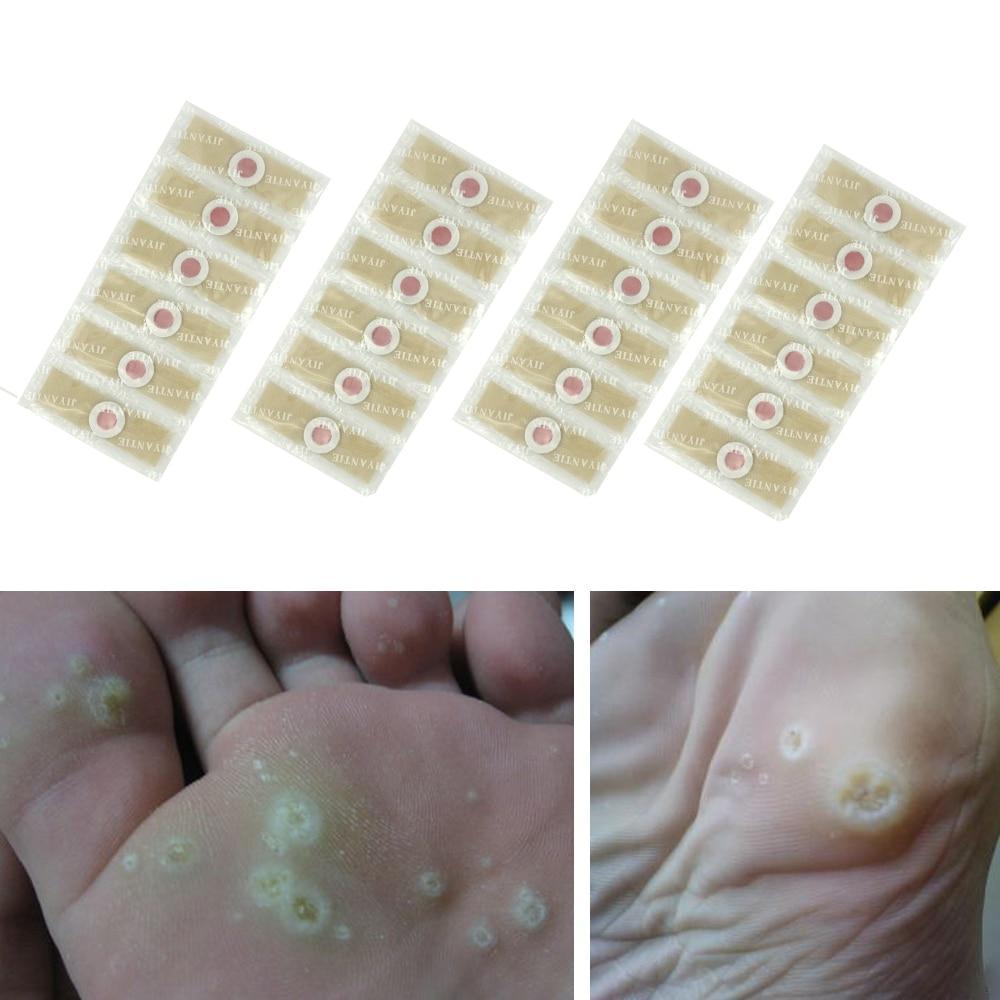 12 pcs Medical Foot Corn Wart Patch