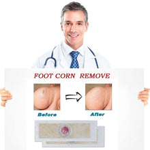 Load image into Gallery viewer, 12 pcs Medical Foot Corn Wart Patch