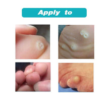 Load image into Gallery viewer, 12 pcs Medical Foot Corn Wart Patch