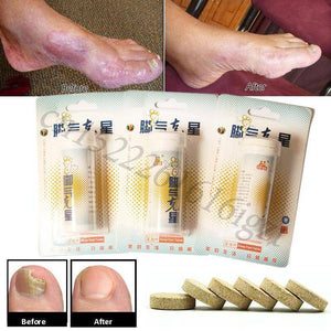 Antifungal Detox Foot Soak