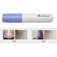 Load image into Gallery viewer, BLACKHEADS VACUUM