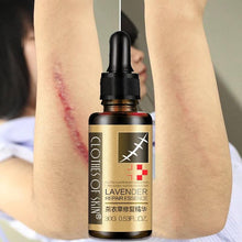 Load image into Gallery viewer, Essential Massage oils Scar Removal