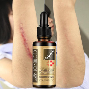 Essential Massage oils Scar Removal