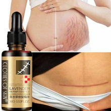 Load image into Gallery viewer, Essential Massage oils Scar Removal