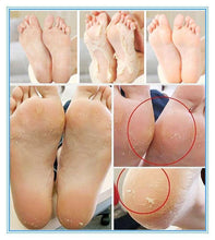 Load image into Gallery viewer, Foot Peeling Exfoliating Socks