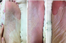 Load image into Gallery viewer, Foot Peeling Exfoliating Socks