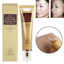 Load image into Gallery viewer, Original Acne Scar Remover Cream