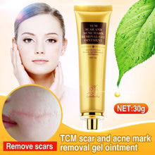 Load image into Gallery viewer, Original Acne Scar Remover Cream