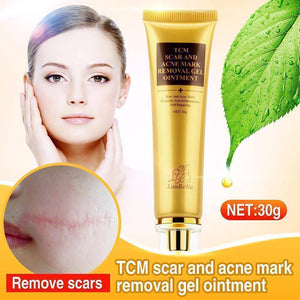 Original Acne Scar Remover Cream
