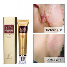 Load image into Gallery viewer, Original Acne Scar Remover Cream